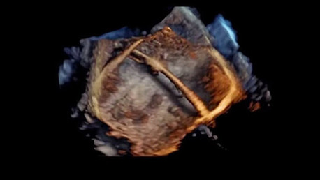 SALUD ECOGRAFIA Así se ve en 4D un corazón humano